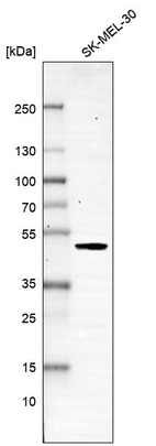 Western blot analysis in human cell line SK-MEL-30.