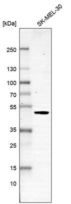 Anti-SMARCB1 Antibody