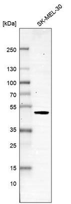 Western blot analysis in human cell line SK-MEL-30.