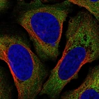 Anti-AIF1 Antibody