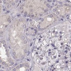 Immunohistochemical staining of human kidney using Anti-BFSP2 antibody HPA062959.