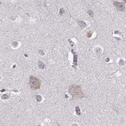 Immunohistochemical staining of human cerebral cortex using Anti-BFSP2 antibody HPA062959.