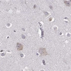Immunohistochemical staining of human cerebral cortex using Anti-BFSP2 antibody HPA062959.