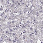 Immunohistochemical staining of human liver using Anti-BFSP2 antibody HPA062959.
