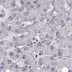 Immunohistochemical staining of human liver using Anti-BFSP2 antibody HPA062959.