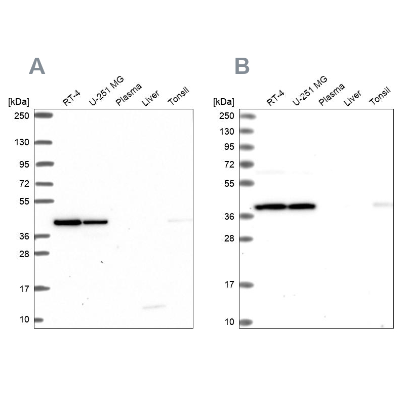 Anti-IDH3A Antibody