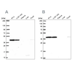 Anti-IDH3A Antibody