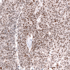 Anti-SMARCB1 Antibody