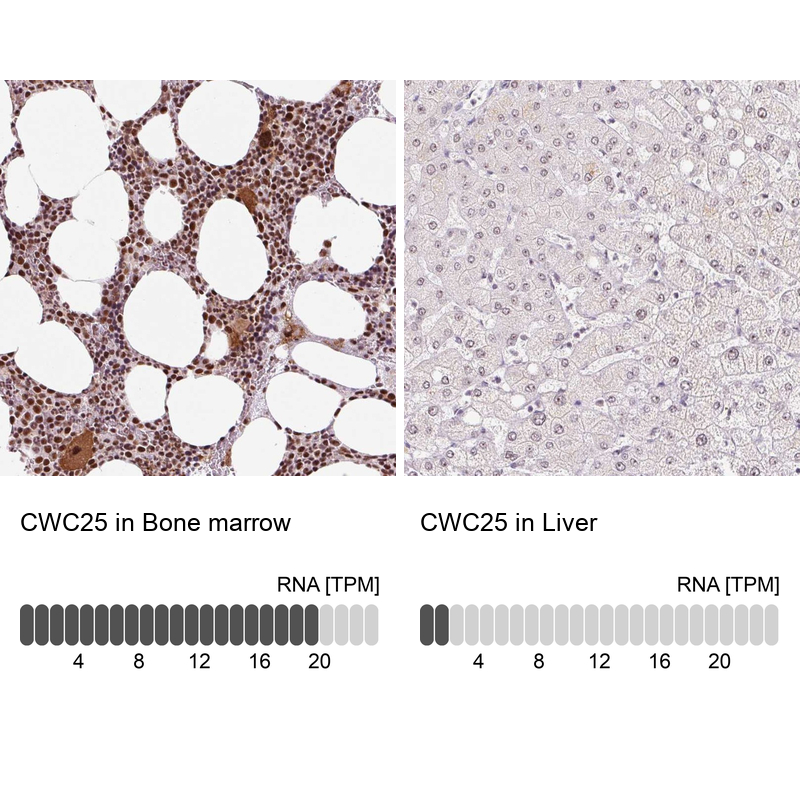 Anti-CWC25 Antibody