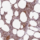 Immunohistochemical staining of human bone marrow shows high expression.