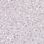 Immunohistochemical staining of human liver shows low expression as expected.