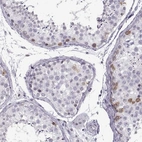 Immunohistochemical staining of human testis shows moderate cytoplasmic and nucleus positivity in cells in seminiferous ducts.