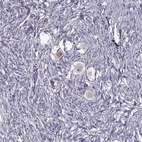 Immunohistochemical staining of human ovary shows moderate cytoplasmic and nucleus positivity in oocyte.