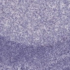 Immunohistochemical staining of human tonsil tissues shows no cytoplasmic positivity in non-germinal center cells as expected.