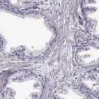 Immunohistochemical staining of human prostate shows no cytoplasmic positivity in glandular cells as expected.