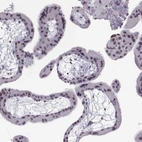 Immunohistochemical staining of human placenta shows no cytoplasmic positivity in trophoblastic cells as expected.