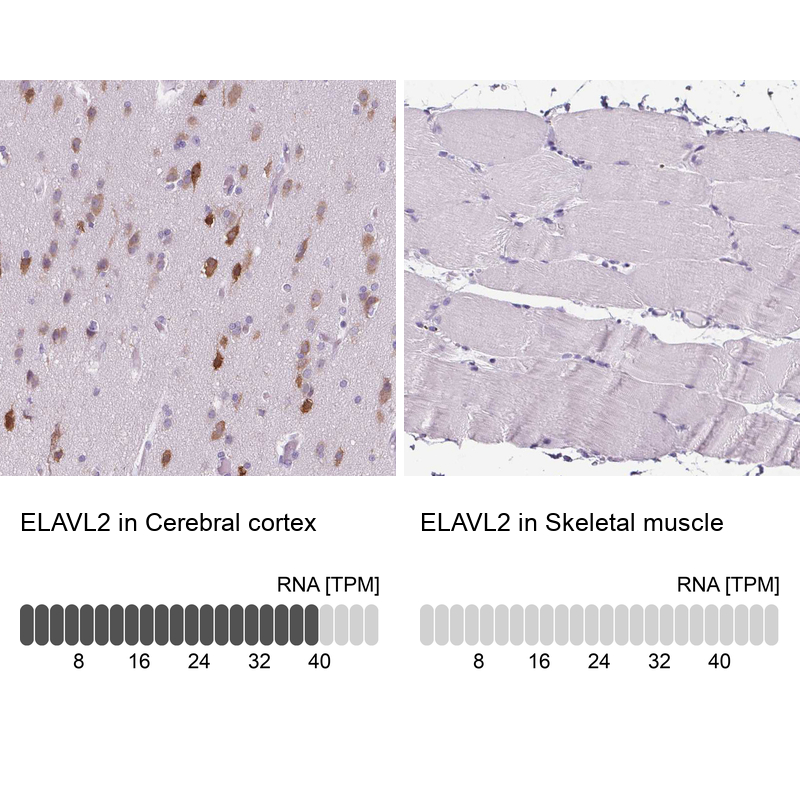 Anti-ELAVL2 Antibody