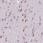 Immunohistochemical staining of human cerebral cortex shows moderate to strong cytoplasmic positivity in neurons.
