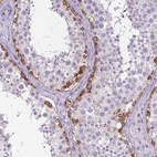 Immunohistochemical staining of human testis shows strong cytoplasmic positivity in cells in seminiferous ducts.