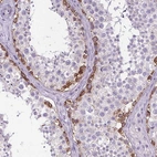Immunohistochemical staining of human testis shows strong cytoplasmic positivity in cells in seminiferous ducts.