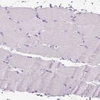 Immunohistochemical staining of human skeletal muscle shows no positivity in myocytes as expected.