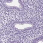 Immunohistochemical staining of human endometrium shows no positivity in glandular cells as expected.