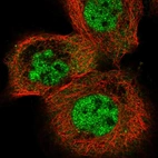 Immunofluorescent staining of human cell line A-431 shows localization to nucleoplasm.