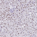 Anti-PBOV1 Antibody