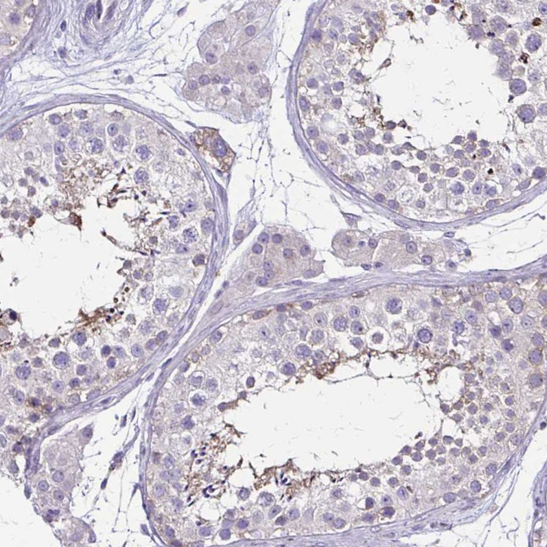 Anti-ULBP3 Antibody