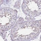 Anti-ULBP3 Antibody