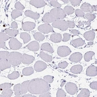 Immunohistochemical staining of human skeletal muscle shows no positivity in myocytes as expected.