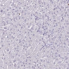 Immunohistochemical staining of human liver shows no positivity in hepatocytes as expected.
