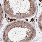 Immunohistochemical staining of human testis shows strong cytoplasmic positivity in Leydig cells.