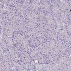 Immunohistochemical staining of human pancreas shows no positivity in exocrine glandular cells as expected.