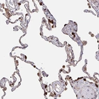 Immunohistochemical staining of human lung shows strong cytoplasmic positivity in pneumocytes.