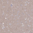 Immunohistochemical staining of human cerebral cortex shows weak positivity in neuropil.