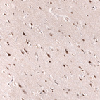 Immunohistochemical staining of human cerebral cortex shows strong nuclear positivity in neurons.