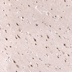 Immunohistochemical staining of human cerebral cortex shows strong nuclear positivity in neurons.