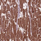 Anti-MYL3 Antibody