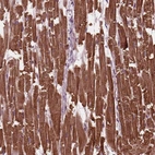 Anti-MYL3 Antibody