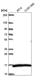 Western blot analysis in human cell line RT-4 and human cell line U-251 MG.
