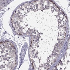 Anti-HSFX2 Antibody