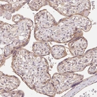 Immunohistochemical staining of human placenta shows moderate membranous positivity in trophoblastic cells.