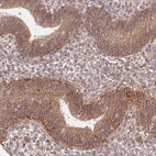 Immunohistochemical staining of human endometrium shows strong membranous positivity in glandular cells.