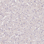 Anti-SLC52A2 Antibody