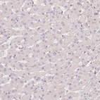 Immunohistochemical staining of human liver shows no membranous positivity in hepatocytes as expected.
