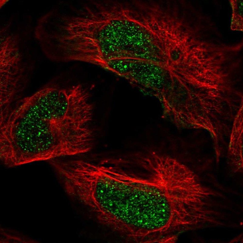 Anti-ARID2 Antibody