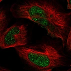 Anti-ARID2 Antibody