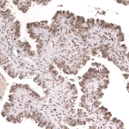 Immunohistochemical staining of human fallopian tube shows strong nuclear positivity in glandular cells.