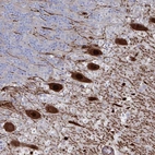 Anti-OR2T1 Antibody
